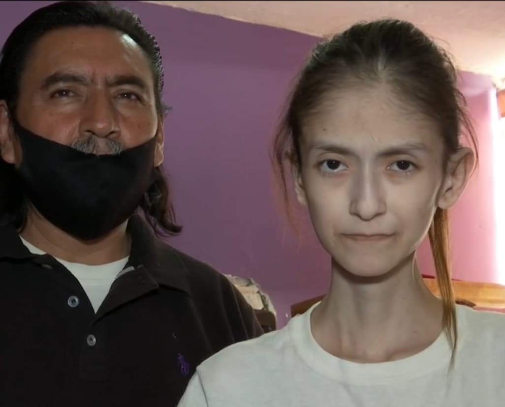 La difícil situación de salud de Ada ha empeorado por el 
<a href="https://www.univision.com/temas/coronavirus">covid-19</a>, debido a que padece Anemia y sus defensas están muy bajas, por lo que eso la convierte
<b> en una paciente de alto riesgo</b> y su ingreso en un hospital podría ser fatal. 
<br>