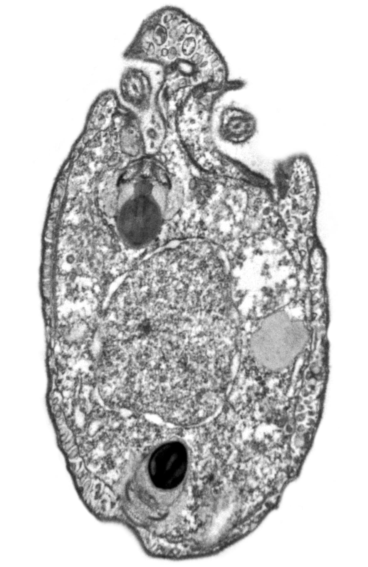 Ancoracysta twista. Este organismo unicelular, perteneciente al orden de los poristas (es decir, no es un animal, planta u hongo, sino un eucariota y su material genético existe en un núcleo que está unido a una membrana). Fue hallado en un coral del acuario del Instituto de Oceanografía Scripps de San Diego, por lo que se desconoce su origen en la naturaleza.