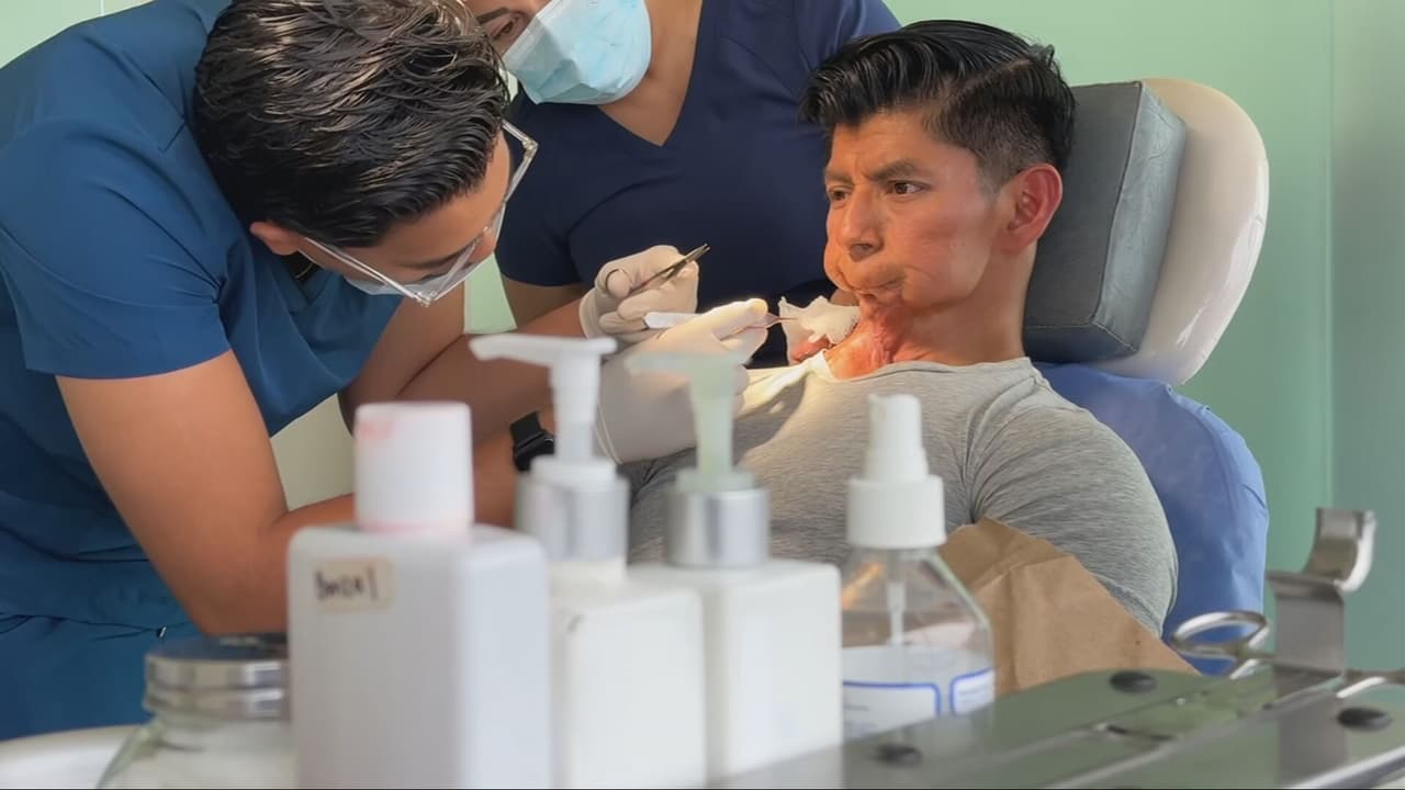 Joven atleta lucha por reconstruir su rostro tras devastadora enfermedad