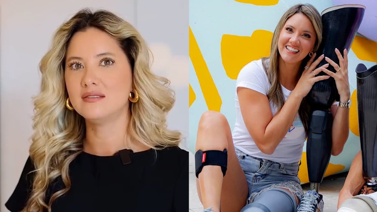 ¿Daniela Álvarez tuvo cáncer antes de que le amputaran la pierna? La modelo hace confesión