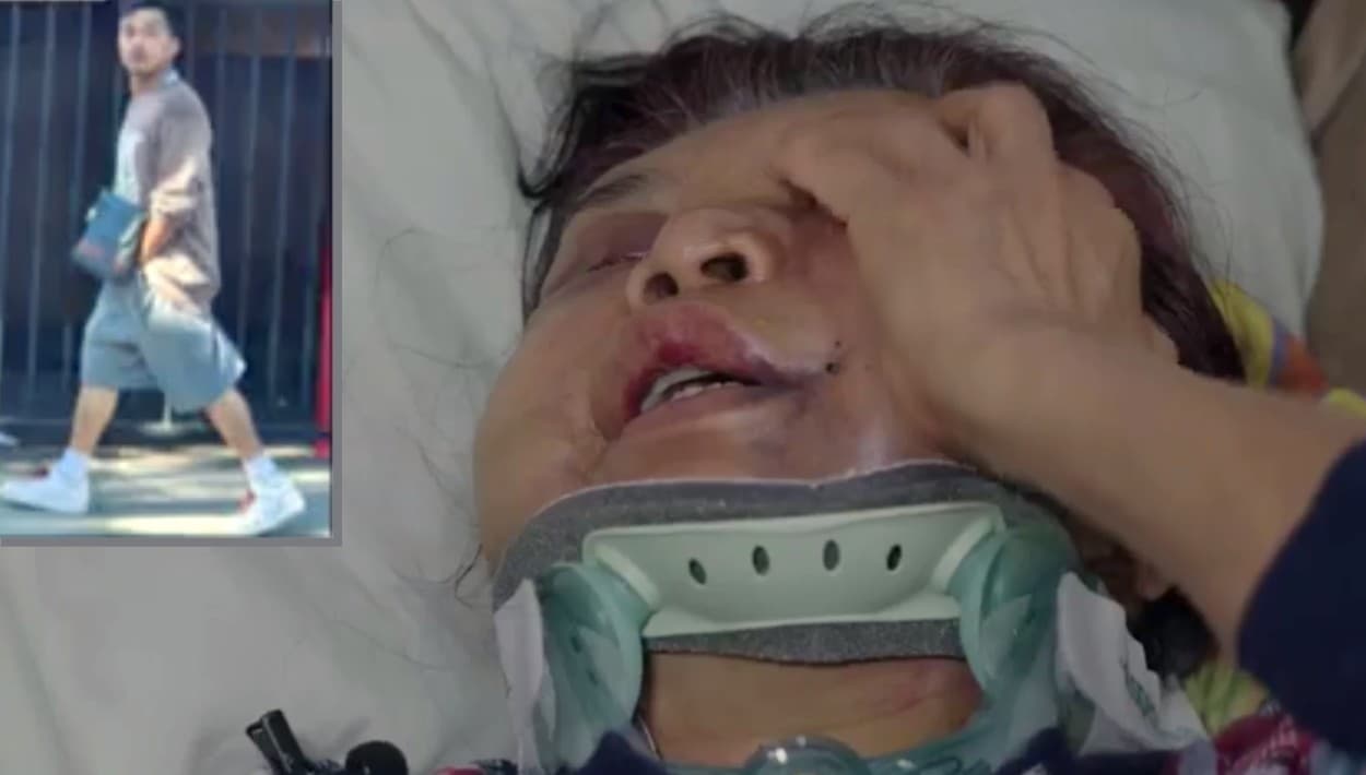 Sheriff va tras Sergio Andrew García, sospechoso de la golpiza a Rosalina Martínez