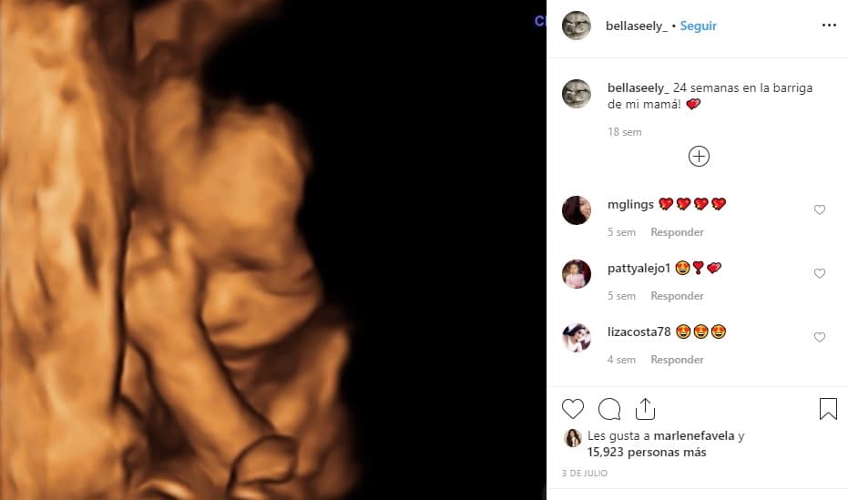 A mediados de octubre pasado, la actriz publicó un video y dijo que revelará el rostro de Bella
<b><a href="https://www.univision.com/famosos/marlene-favela-revela-que-le-presentara-a-su-hija-al-mundo-luego-de-una-cita-con-la-virgen-de-guadalupe-video" target="_blank">después de que la presente</a></b> ante la Virgen en la Basílica de Guadalupe, en México.