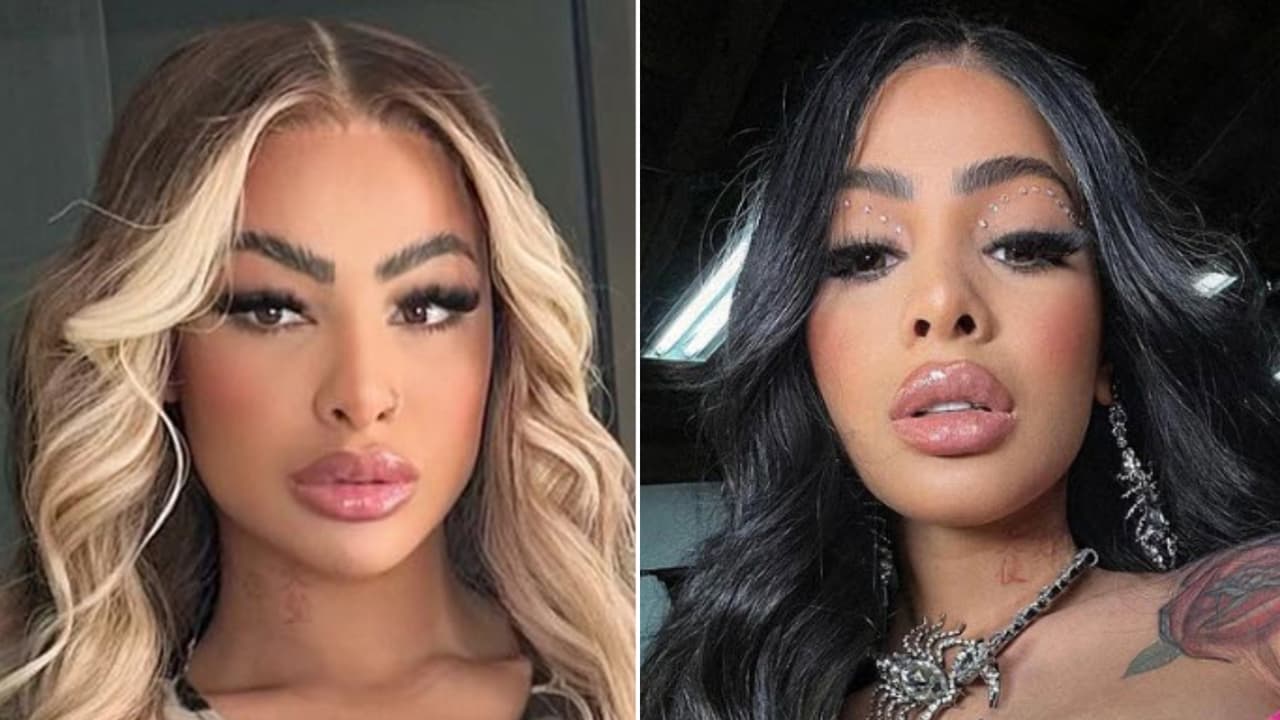 Circula foto de Yailin herida y con golpes en la cara: esto se sabe sobre lo que le habría pasado