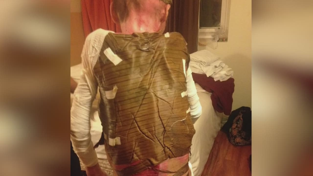 Mujer víctima de prostitución y tráfico humano fue quemada y sus hijas secuestradas