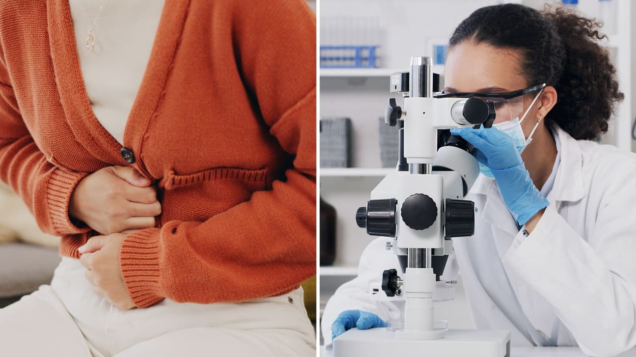 Confirman casos de ciclosporiasis en el norte de Texas: ¿qué síntomas vigilar?