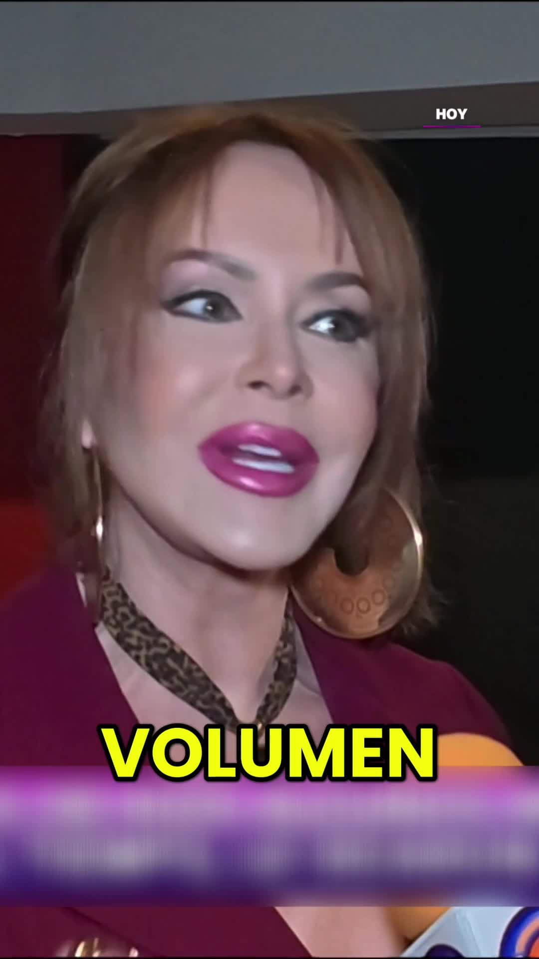 Gaby Spanic se retira granulomas y SORPRENDE con su nueva imagen