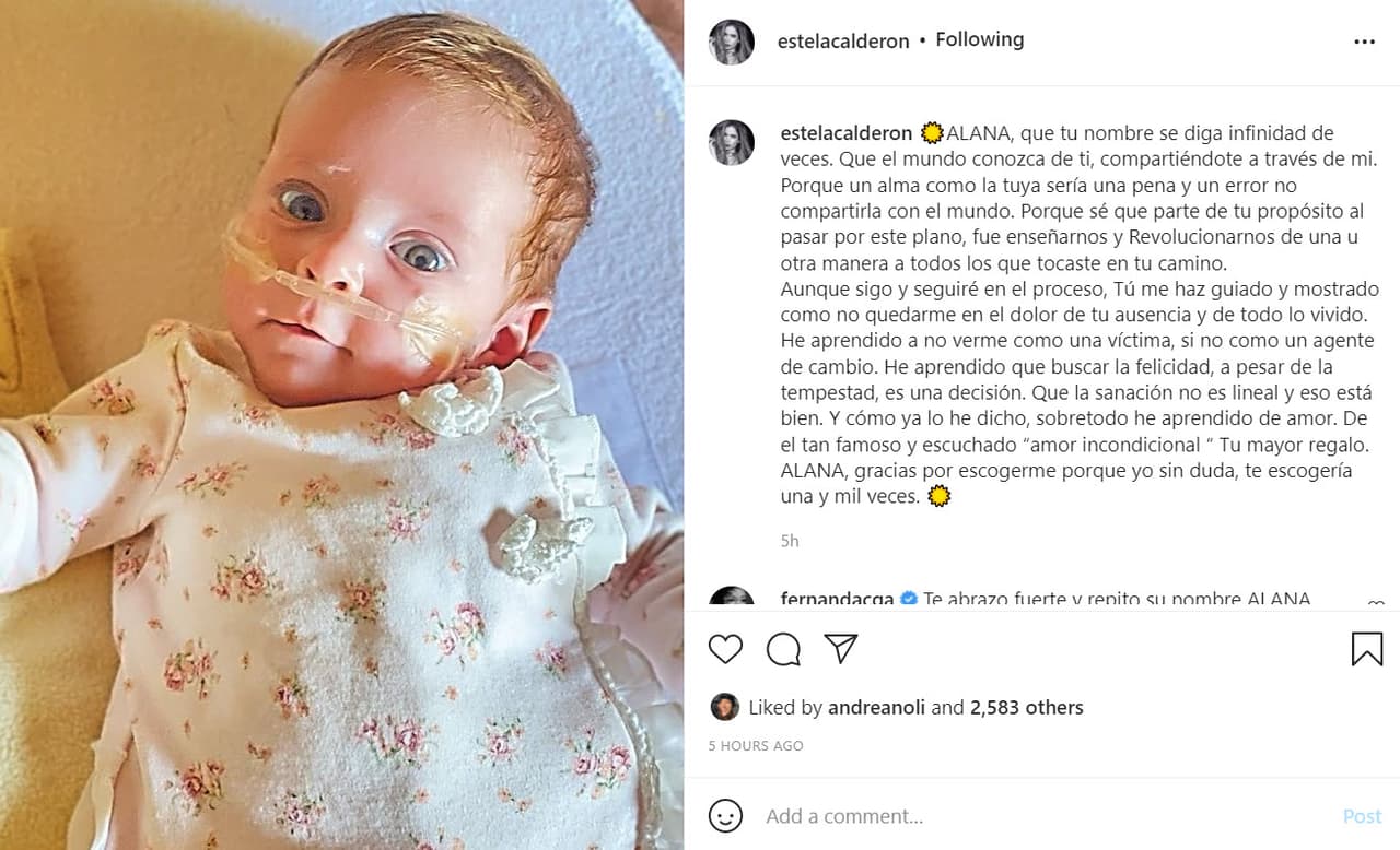 Alana, la fallecida hija de Estela Calderón.