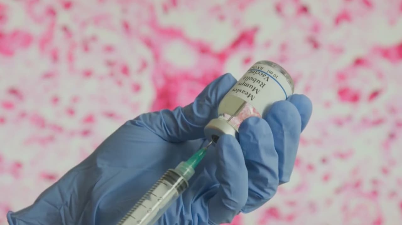 Posible caso de sarampión detectado en el aeropuerto O’Hare de Chicago