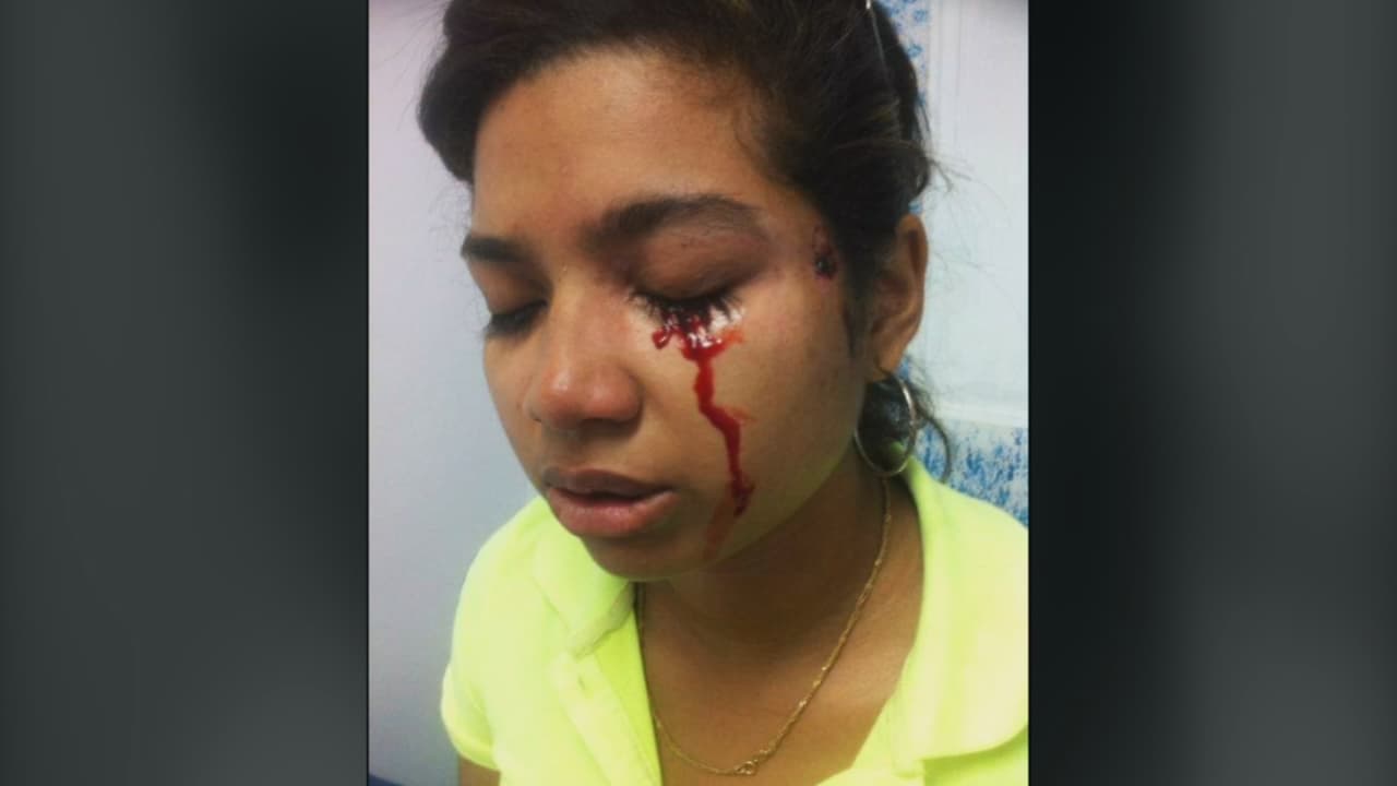 Coronado, quien emitía un olor fétido con sangre, fue intervenida de emergencia a causa de una septicemia. Y si bien pudo salvar su vida, su salud ha ido empeorando con el correr de los años que le han traído un tumor en el conducto lacrimal y heridas en todo el cuerpo que le dejaron marcas. 
<b>“Ahorita tengo en mi pierna, brazo, cabeza, aunque lo de la pierna es preocupante porque ya son tres meses en los que nadie me da una solución”, se lamenta la joven. </b>