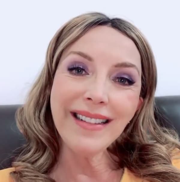 Compartió con las conductoras del programa, Consuelo Duval, Natalia Téllez y Daniela Magún, la ocasión en la que 
<b>se sometió a una aplicación de bótox</b> para suavizar las arrugas en el rostro y que obtuvo un 
<b>resultado inesperado</b> en medio de un proyecto de televisión.