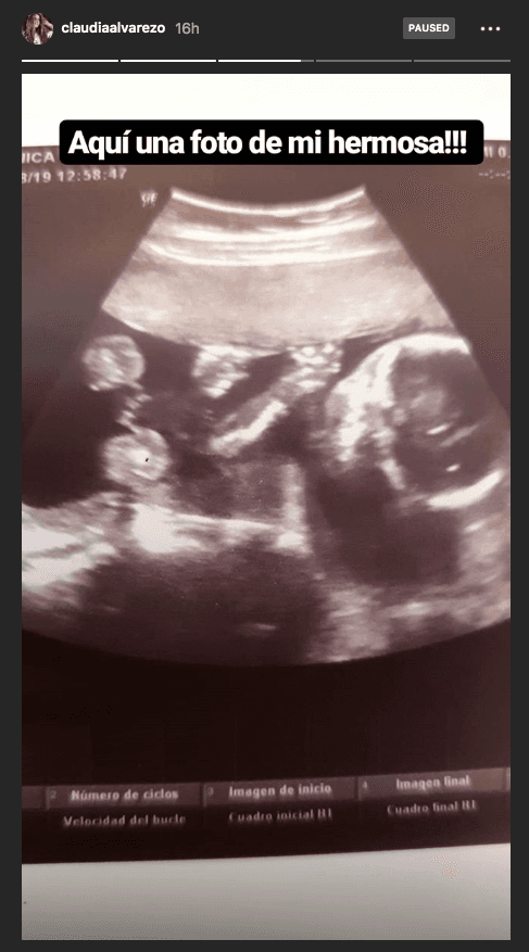En sus historias de Instagram, la protagonista de telenovelas como 
<b><a href="https://www.univision.com/shows/simplemente-maria">Simplemente María</a></b> hizo del dominio público una imagen de ultrasonido de su hija.