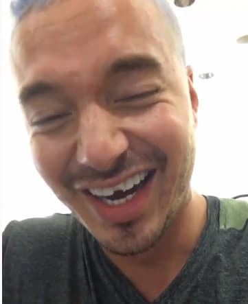 Más allá de que le diera vergüenza, se mostró tal cual, asegurando que es algo que "le pasa a cualquier". Mientras, José Álvaro Osorio, verdadero nombre del cantante, reía al verse con su diente despostillado.