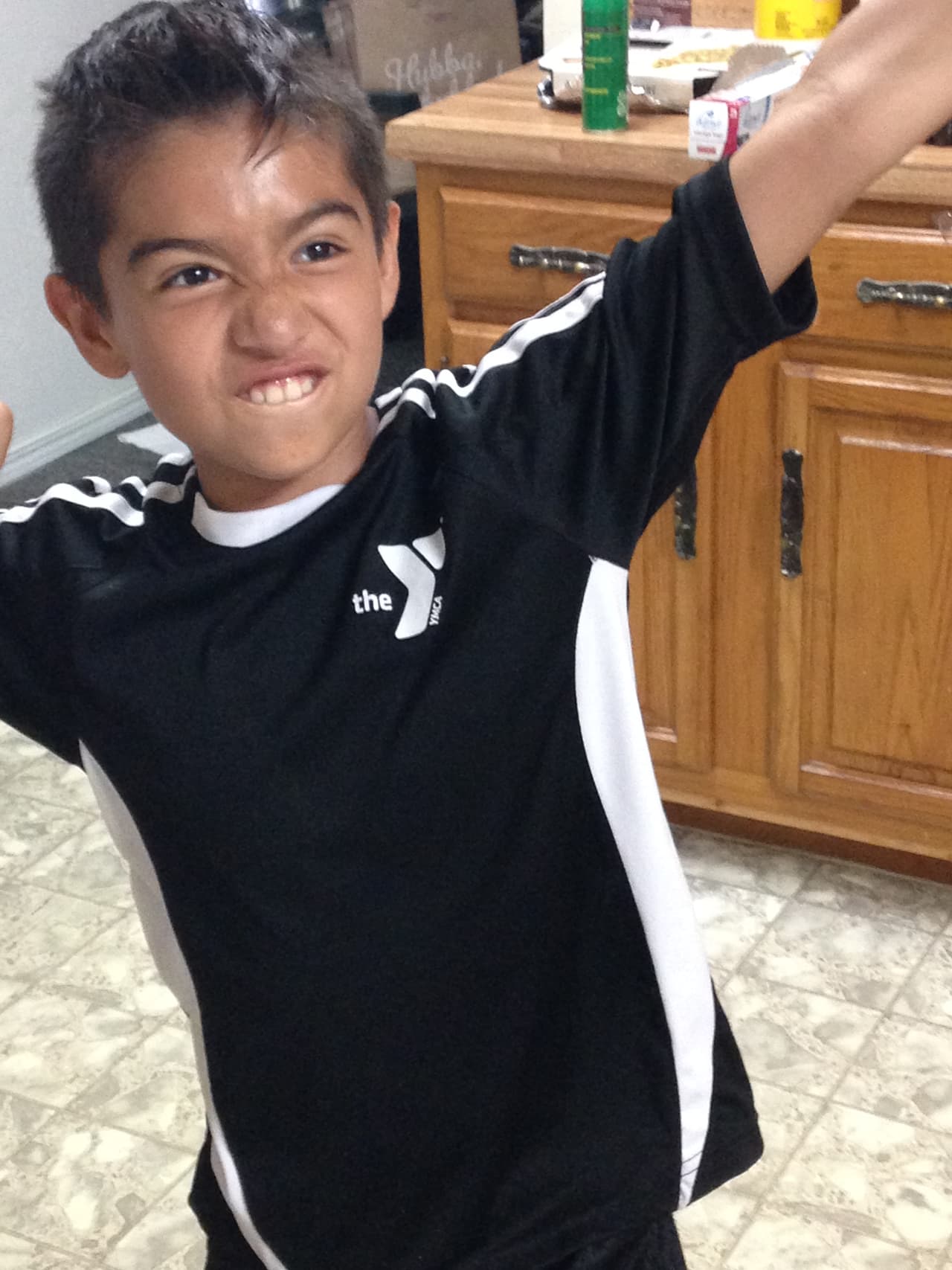 La escoliosis es una curvatura lateral de la columna vertebral que ocurre con mayor frecuencia durante el período de crecimiento anterior a la pubertad.
<br>