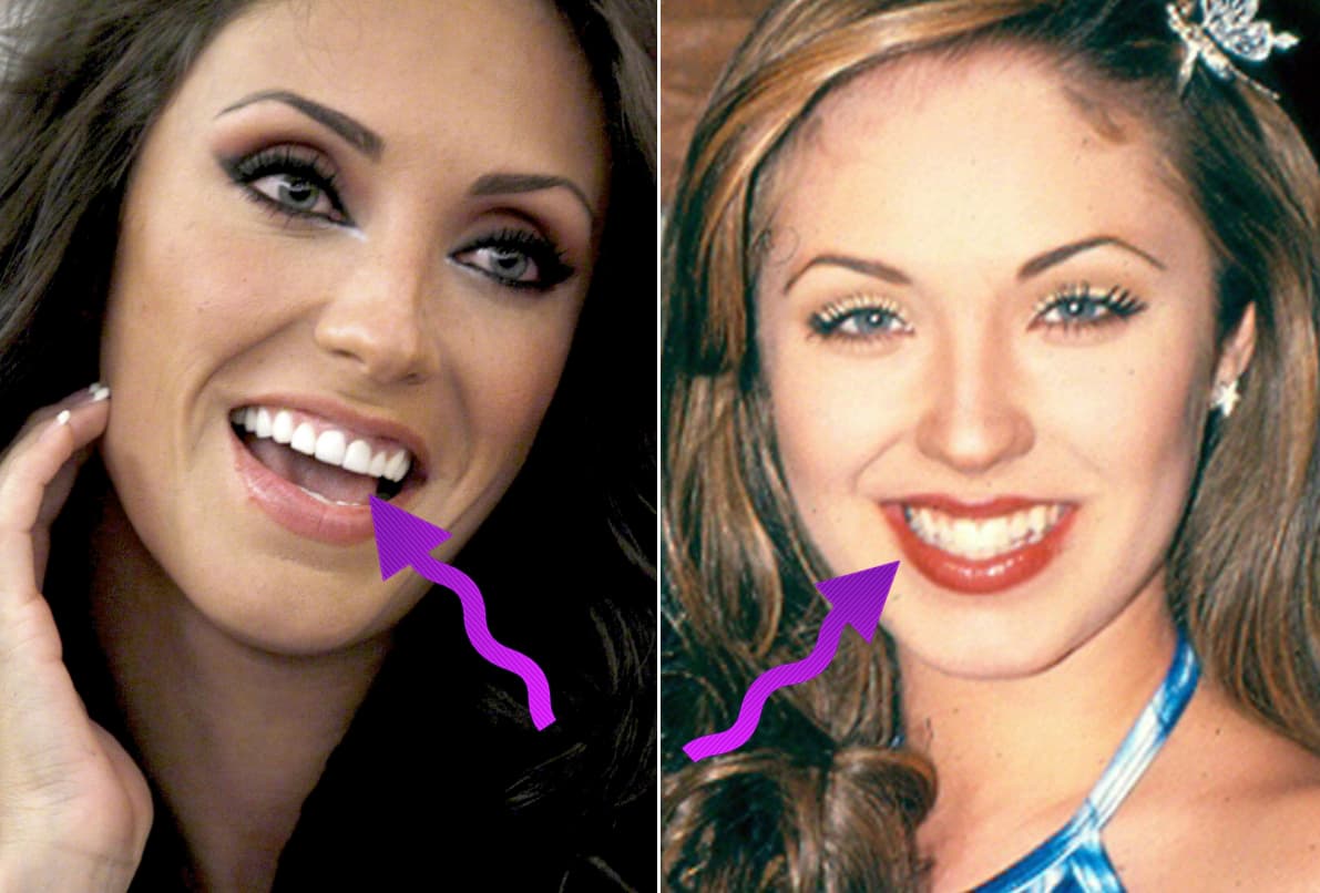 Lo que no puede ocultar es que por lo menos al destista sí acudió.