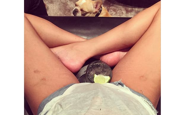 Chrissy compartió esta foto de sus piernas con estrías. La publicación se hizo viral y recibió muchos mensajes positivos de mujeres que agradecieron a la modelo por inspirarlas a aceptar estas marcas incómodas.