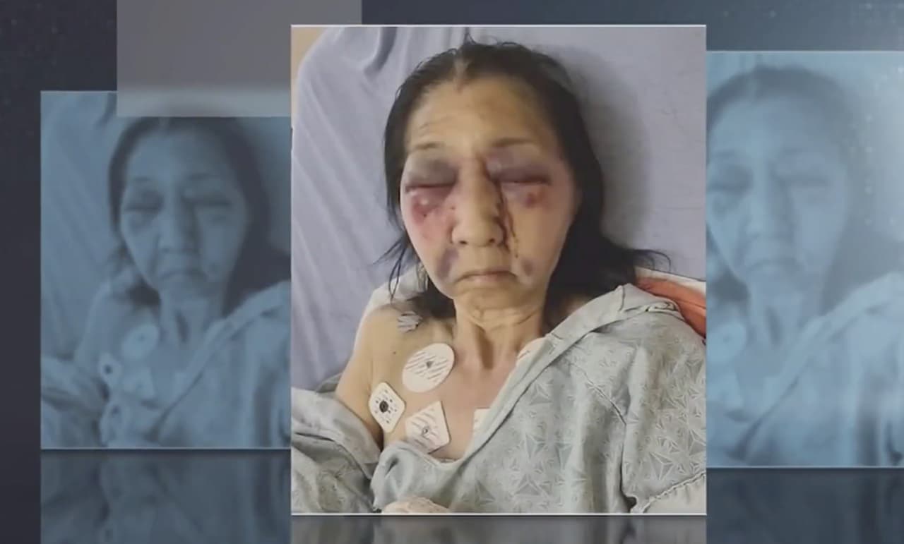 "Una persona latina que sea victimizada, o que ha sido el blanco de un ataque como estos me sorprendió. Muchos asiáticos tienen mucho miedo, no están saliendo", 
<a href="https://www.univision.com/shows/noticiero-univision/por-creer-que-era-asiatica-una-joven-golpea-a-una-anciana-y-la-deja-gravemente-herida-video">dijo Ben Pak, activista comunitario de la comunidad asiática</a> y agregó que "la administración pasada de este país dejó que la gente podía expresar el odio que tiene y estamos siendo las víctimas de este tipo de acción".