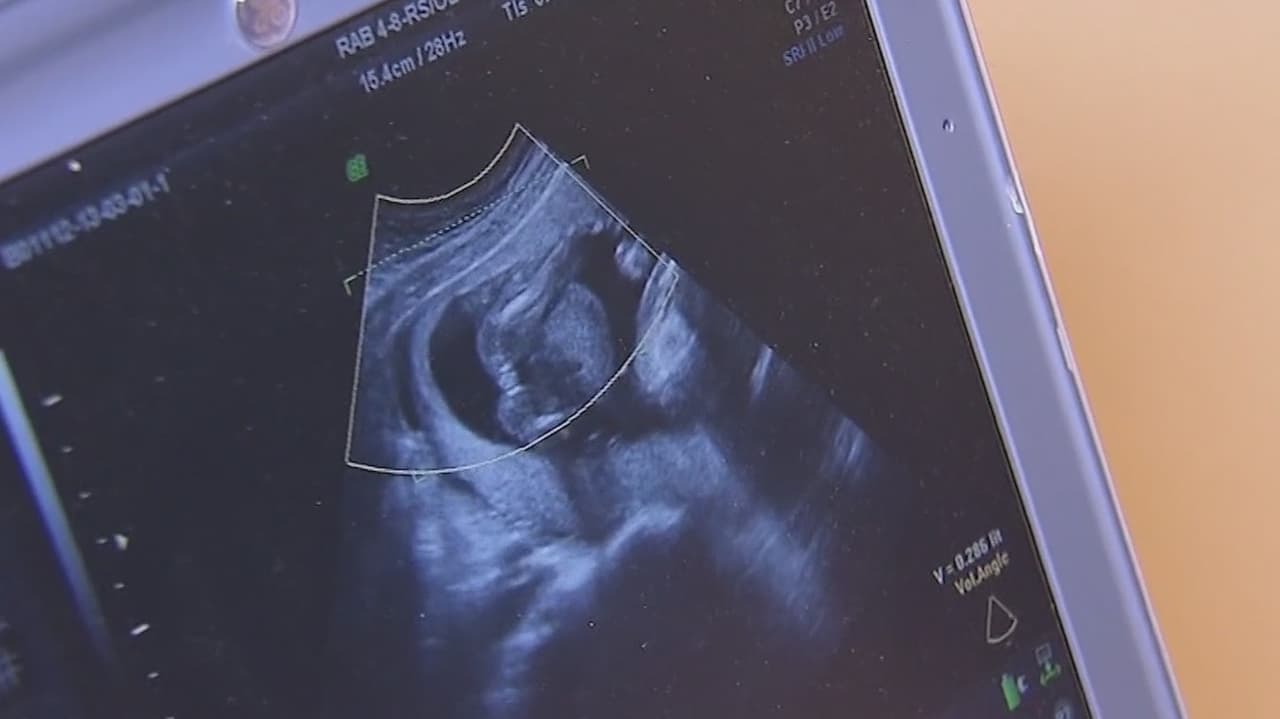 Los votantes de Florida decidirán si proteger el derecho al aborto y legalizar la marihuana en noviembre