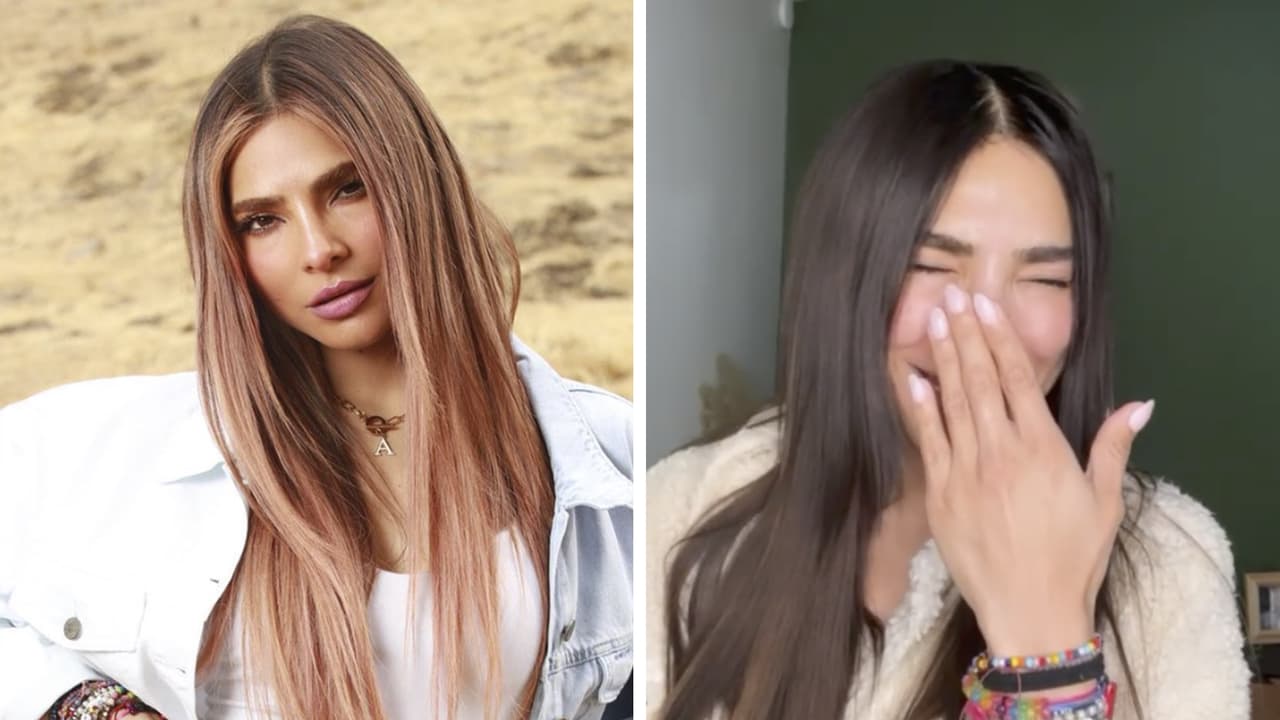 Con humor, Alejandra Espinoza considera "estúpido" el accidente que tuvo y narra lo que pasó