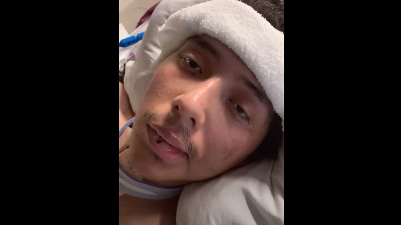 Al hispano se le reventó una arteria desde el cerebro hasta el corazón, además presentó otras lesiones graves, le amputaron las dos piernas, tuvo nariz rota, fractura pélvica y muchos problemas menores, asegura su madre Aracely De la Cruz.