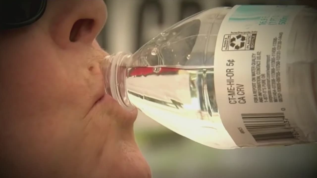 Ayuno intermitente y falta de agua ¿pueden desencadenar migrañas? Un neurólogo lo aclara