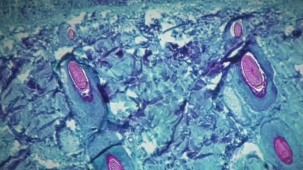 El estado dorado se encuentra en el 
<b>segundo lugar de infectados en EEUU</b> y los casos aumentan aceleradamente. En la ciudad de Long Beach, las autoridades sanitarias locales reportaron que en una semana los casos se triplicaron.