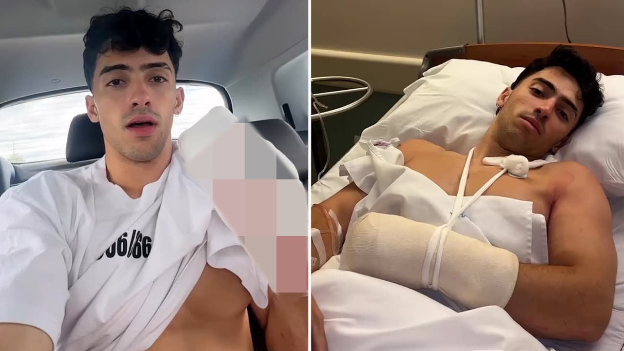 Famoso ‘influencer’ cae de un acantilado y pierde dos dedos: registra el momento en video