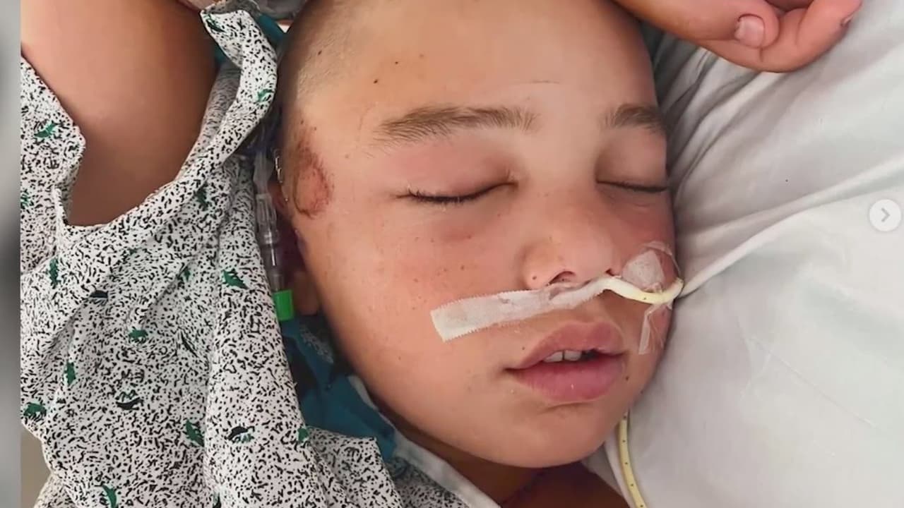 “Ya puede comer y caminar”: Niño de 12 años que se cayó de una litera mejora en el hospital