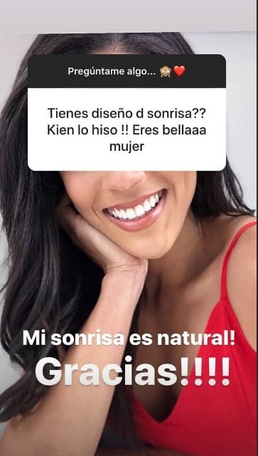 Otra pregunta sobre su apariencia física fue acerca de su sonrisa, la dominicana confesó que es completamente natural y la presumió con una bella fotografía al fondo.