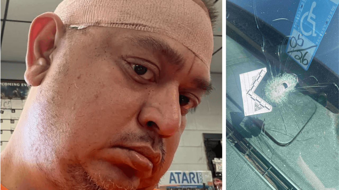 Conductor de Uber recibe un balazo en la cabeza y afirma manejar hasta un hospital con sus pasajeras