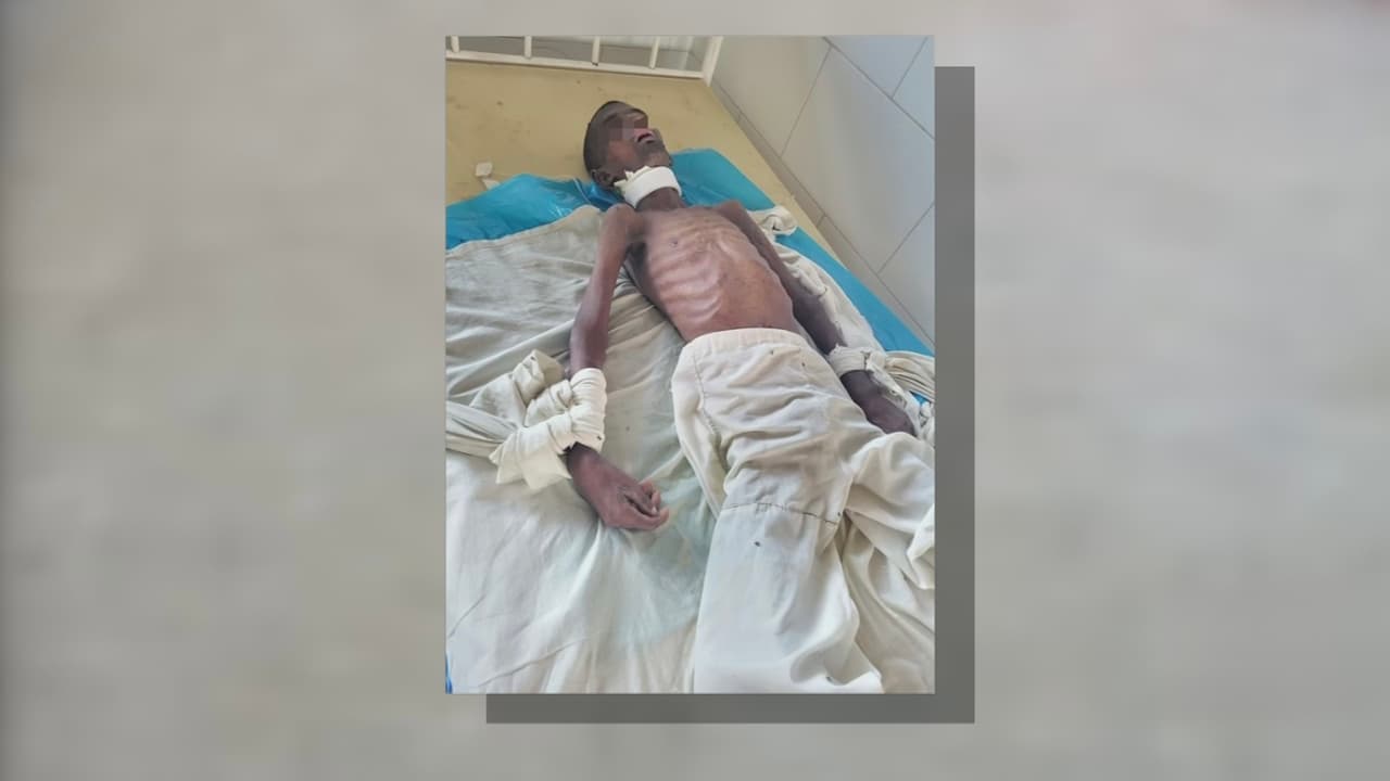 Denuncian abandono de pacientes en el Hospital Amalia Simoni de Camagüey, Cuba
