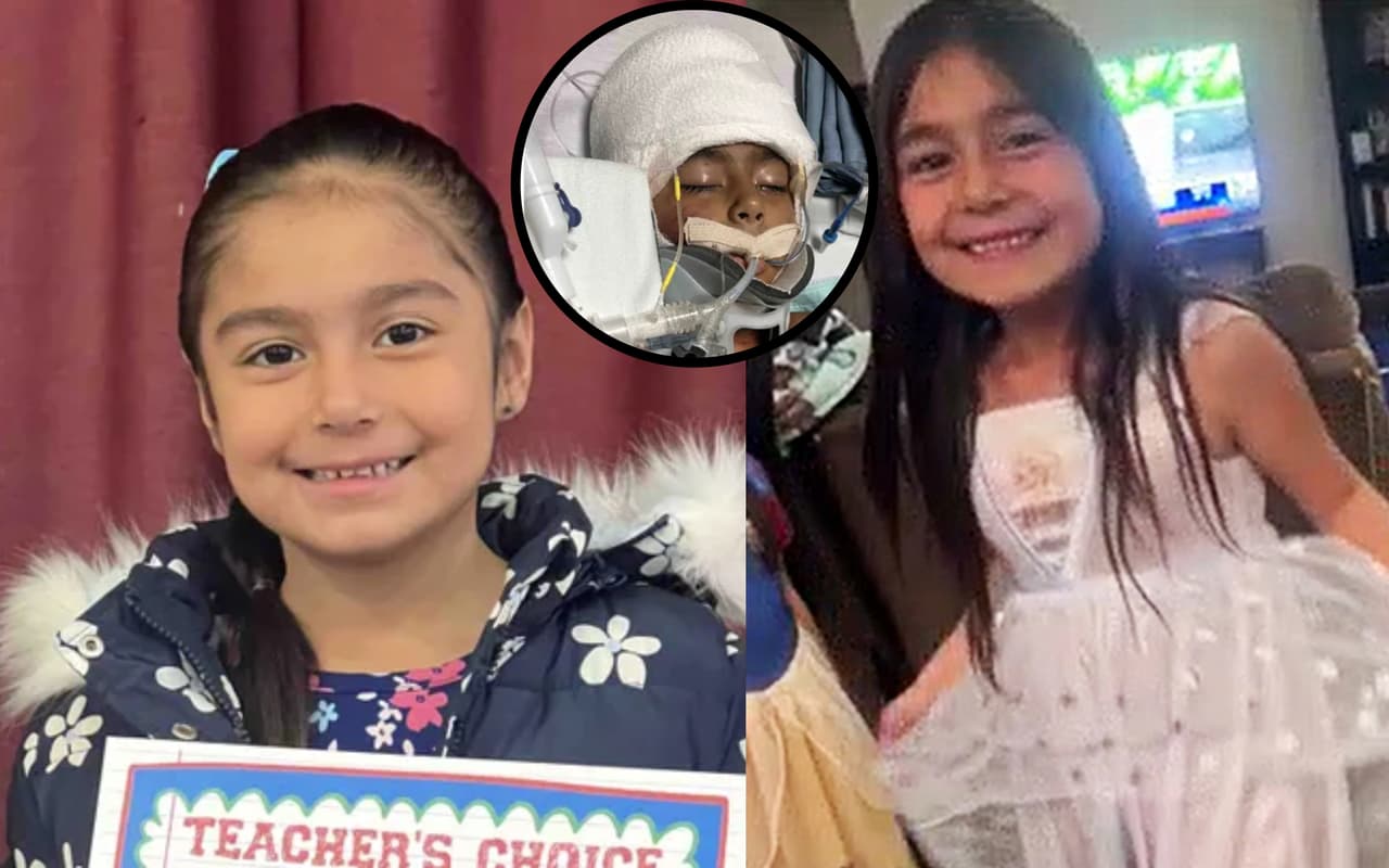 Niña lucha por su vida tras ser atacada por perros pitbull en casa de su abuela