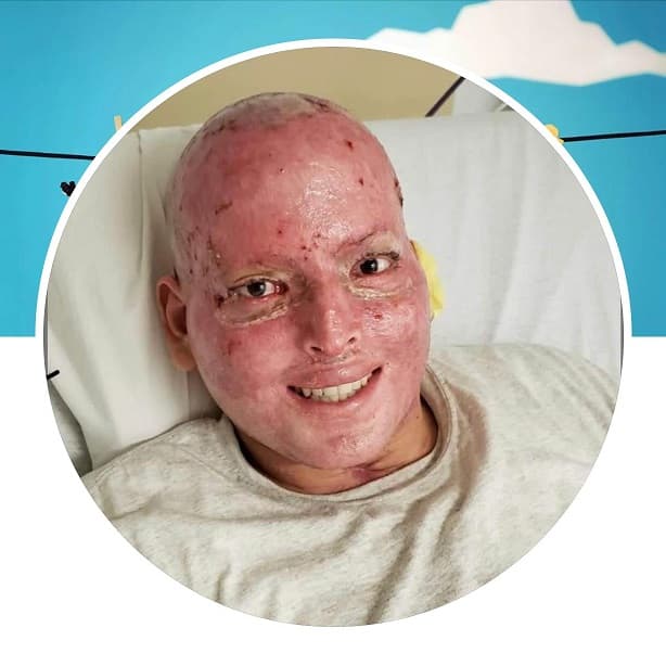 Alexis Hernández comparte imagen de su recuperación 