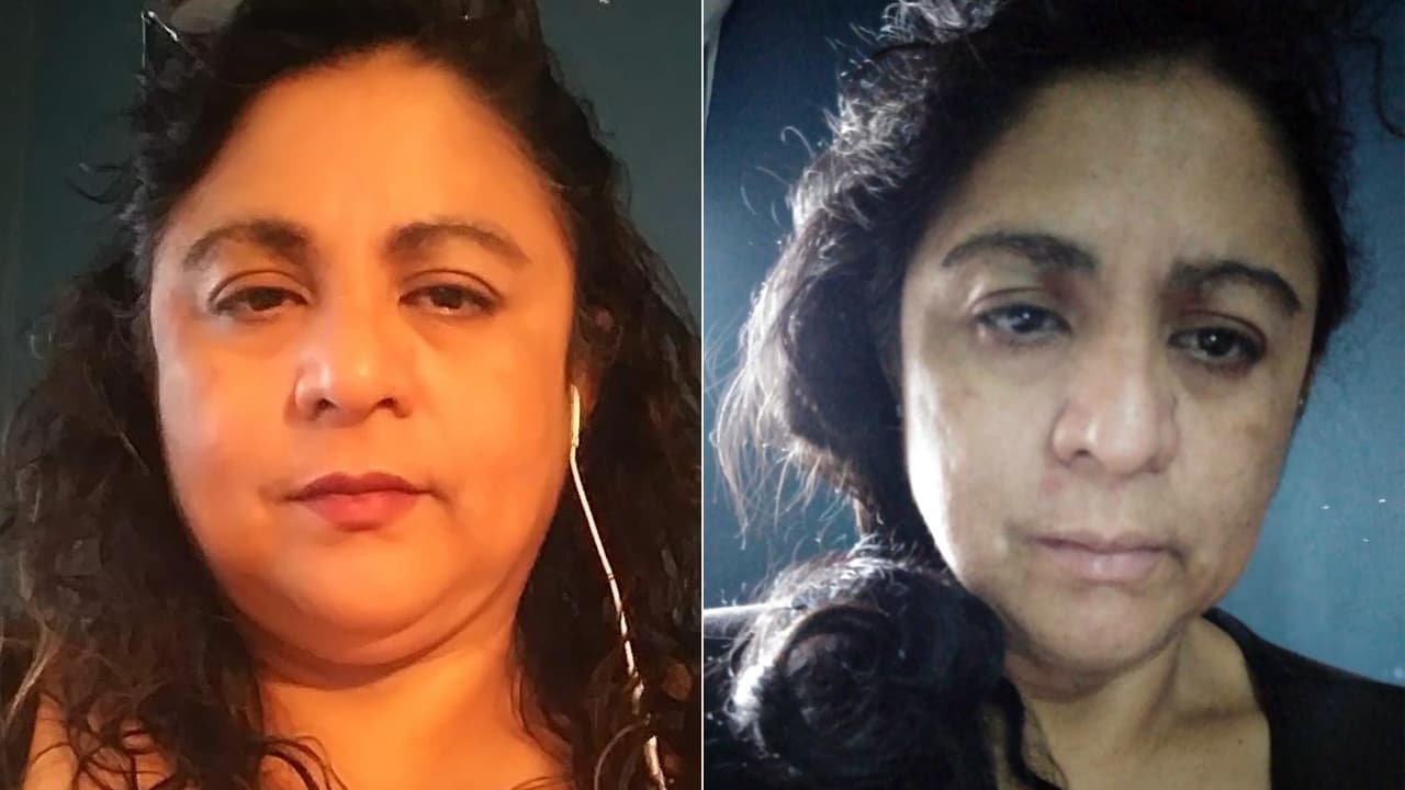 Ruth Roca envió dos fotos para mostrar cómo lucía antes del coronavirus y cómo está ahora.