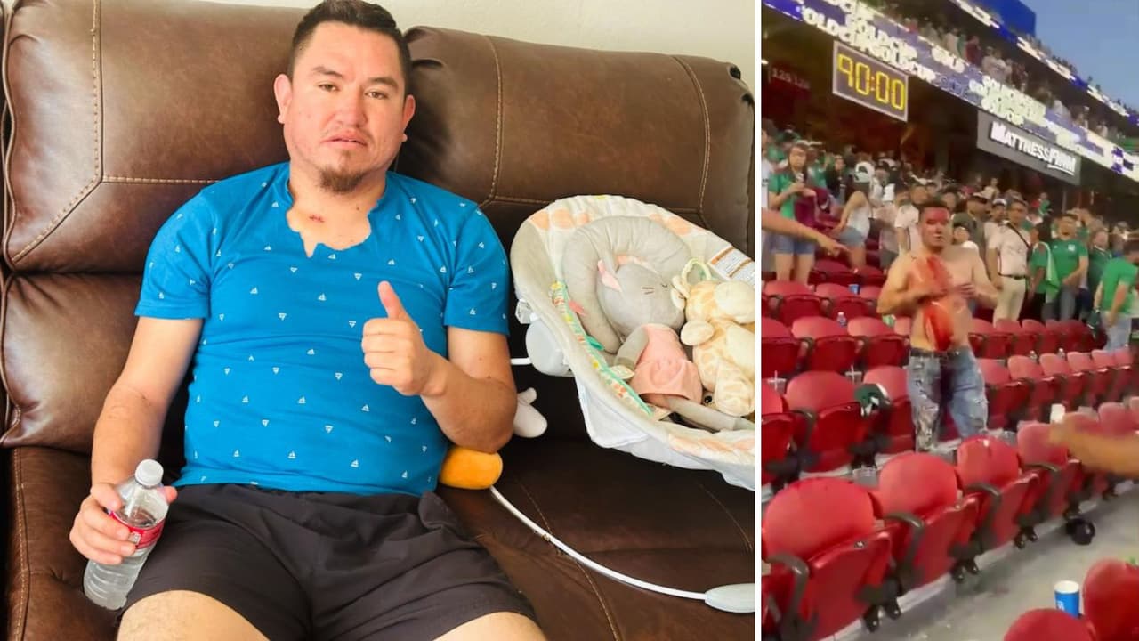 Ya está en casa: aficionado apuñalado en partido de México contra Catar tramitará la Visa U