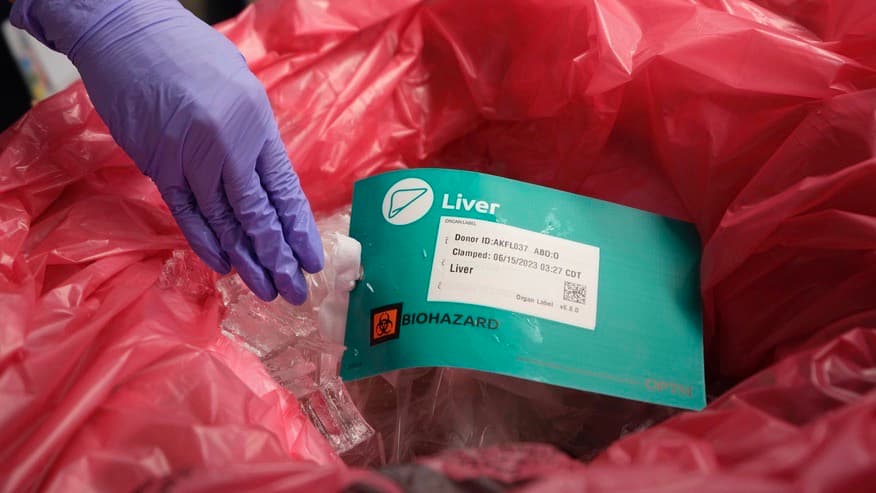 Nueva técnica de trasplante de órganos parece salvar más vidas, pero también despierta polémica