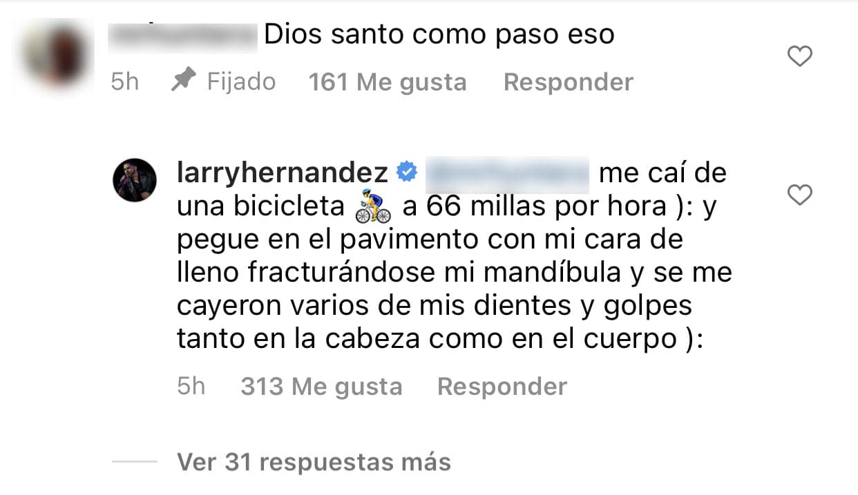 "Me caí de una bicicleta a 66 millas por hora", explicó a uno de sus seguidores. Rememoró que su cara "pegó en el pavimento" y eso le provocó la fractura en la mandíbula, además de "golpes tanto en la cabeza como en el cuerpo".