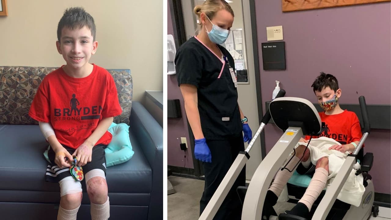 ‘Detenerse, caer y girar’: la maniobra que salvó a un niño de peores quemaduras