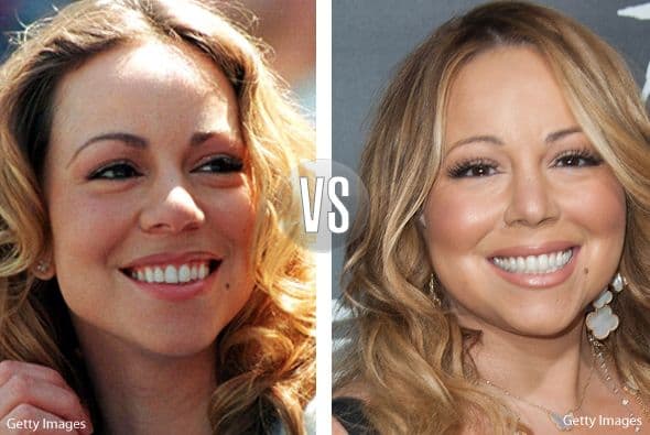 La operación de Mariah Carey es casi imperceptible, pero algo hay en esa nariz.