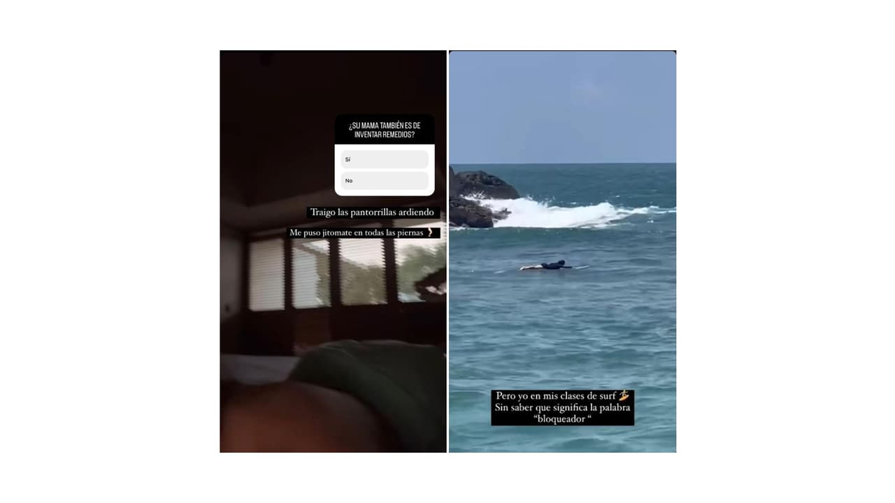 La actriz sufrió quemaduras solares por falta de bloqueador solar y terminó 'tumbada' en la cama.