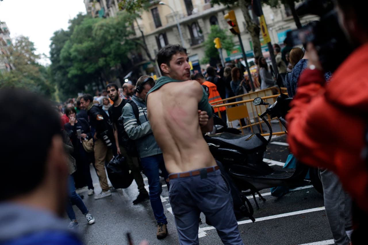 Barcelona ha sido el centro de los mayores casos de violencia. Los agentes policiales dispararon balas de goma (cuyo uso es ilegal en esta comunidad) y usaron bastones para dispersar las manifestaciones proindependentistas. Un joven muestra un rasponazo en la espalda durante los enfrentamientos.