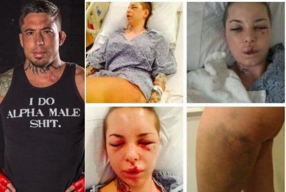 Jon Koppenhaver 'War Machine' golpeó a su novia Christy Mack, estrella porno, provocándole 18 fracturas en el rostro. El peleador de MMA fue atrapado y remitido a las autoridades