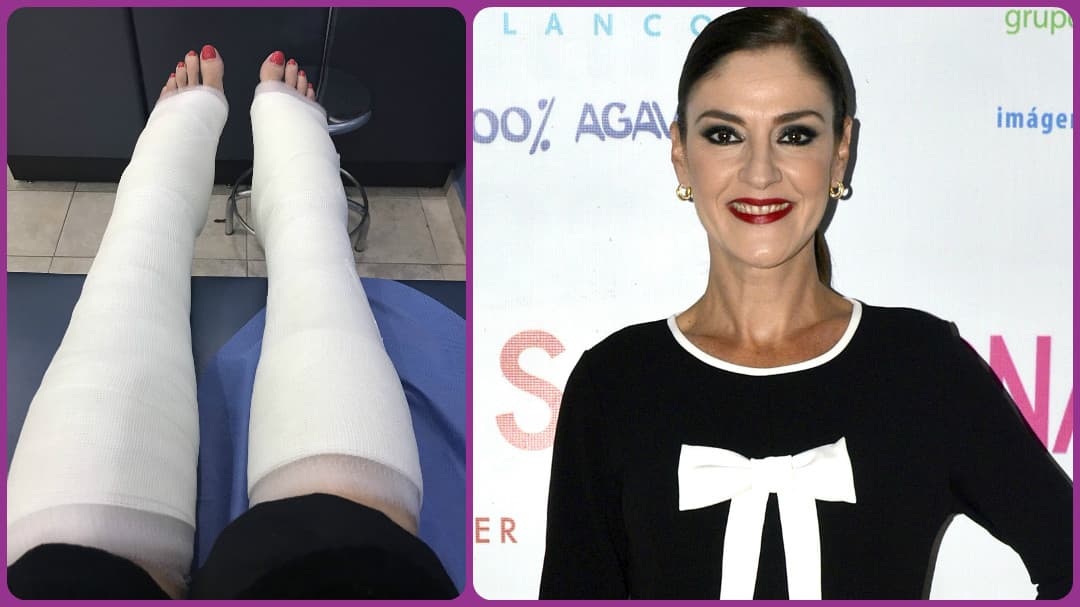 Chantal Andere se fractura los talones tras accidente 