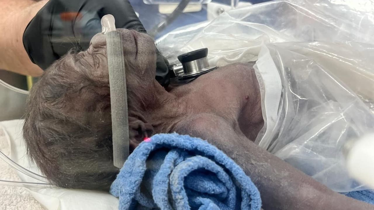 El nacimiento de la bebé gorila, 
<b>resultado de una cesárea de emergencia </b>realizada por el equipo veterinario del zoológico con la asistencia de especialistas médicos, fue un momento histórico y lleno de emoción. La madre gorila, Sekani, 
<b>mostraba signos de preeclampsia, una condición sería que requería intervención inmediata</b> para salvar tanto su vida como la de su bebé.