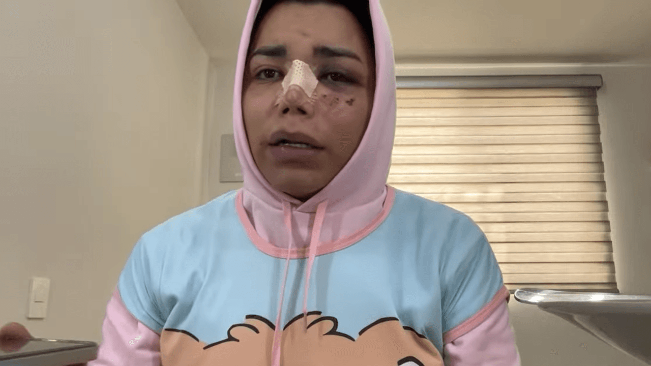 Tras sufrir una agresión física, Paolita Suárez se ha mantenido activa en redes sociales.