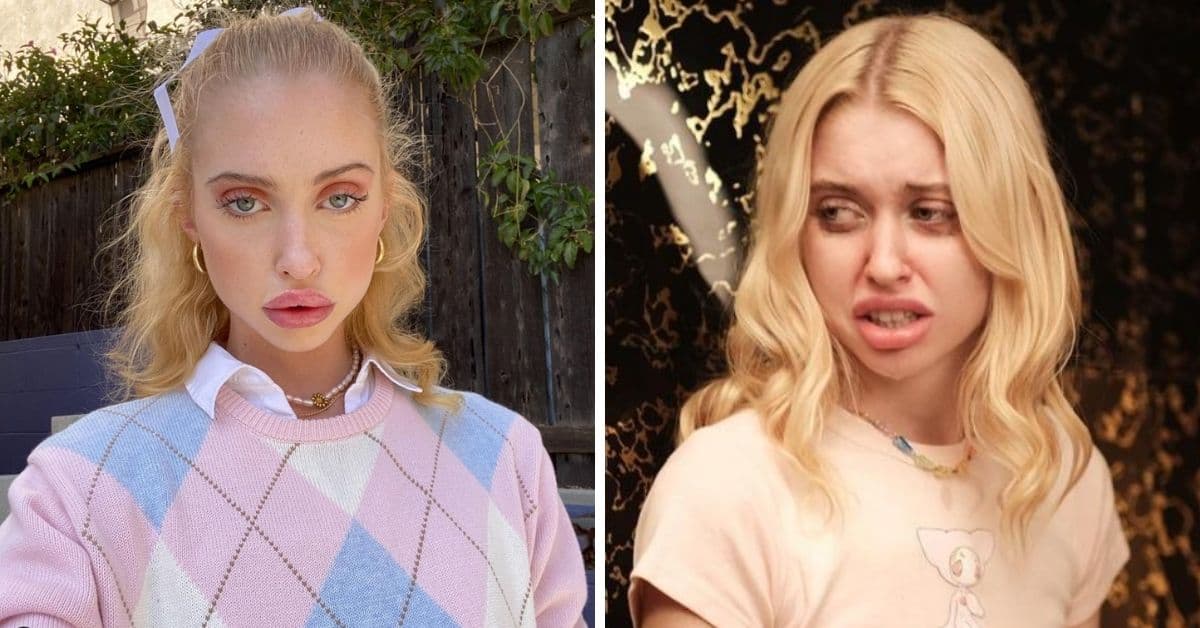 Hicieron memes y burlas de los labios de Faye: así reaccionaron los fans y Chloe Cherry