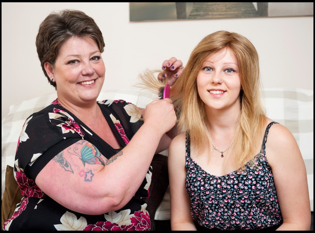 Jo se deshizo de su cabello porque Lauren sufre de alopecia.