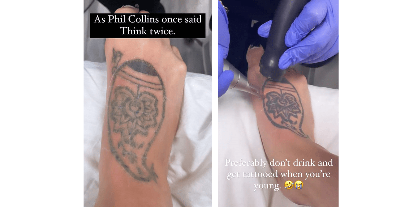 Eiza González es parte de los famosos que se han borrado un tatuaje