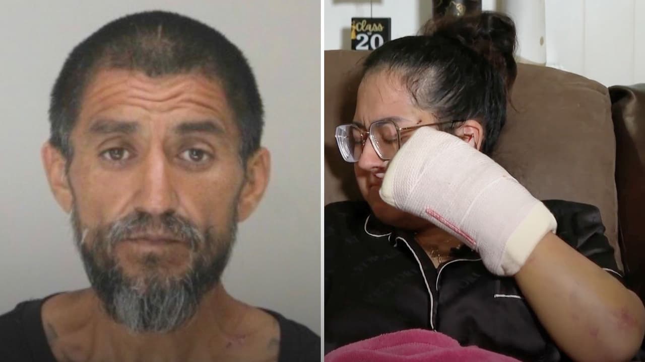 Con fracturas y heridas, hispana narra cómo sobrevivió a ataque con una pala en Dallas