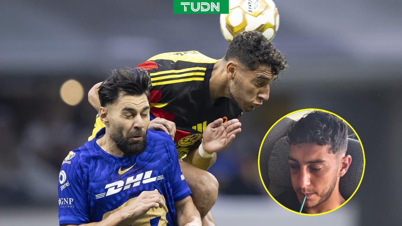 Sebastián Cáceres sufre fractura y es duda para la vuelta vs Pumas
