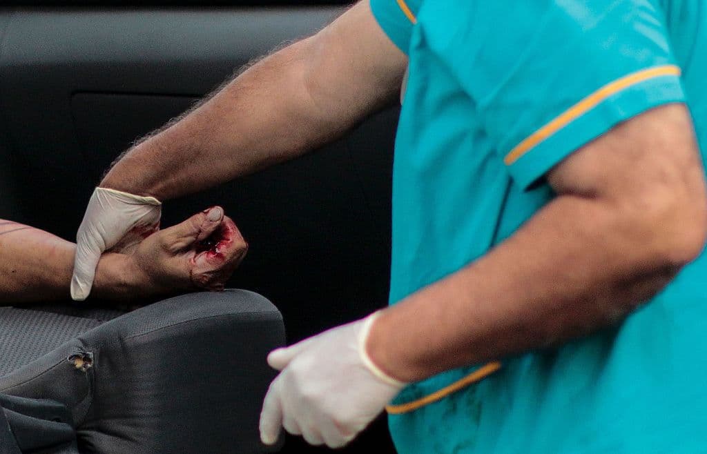 Dos de las seis personas abaleadas murieron en el hospital